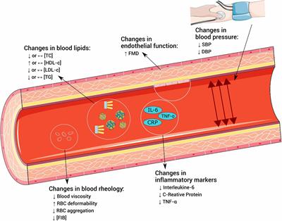 Exercise, Cardiovascular Health, and Risk Factors for Atherosclerosis: A Narrative Review on These Complex Relationships and Caveats of Literature